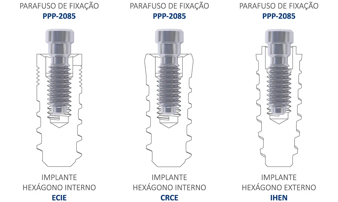 Implante Hexágono Externo ou Hexágono Interno Medens use o mesmo parafuso!