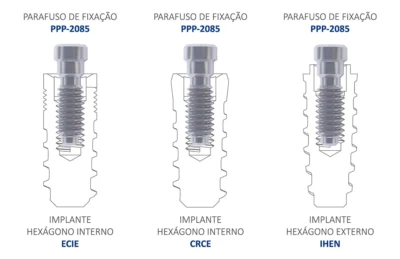 Implante Hexágono Externo ou Hexágono Interno Medens use o mesmo parafuso!