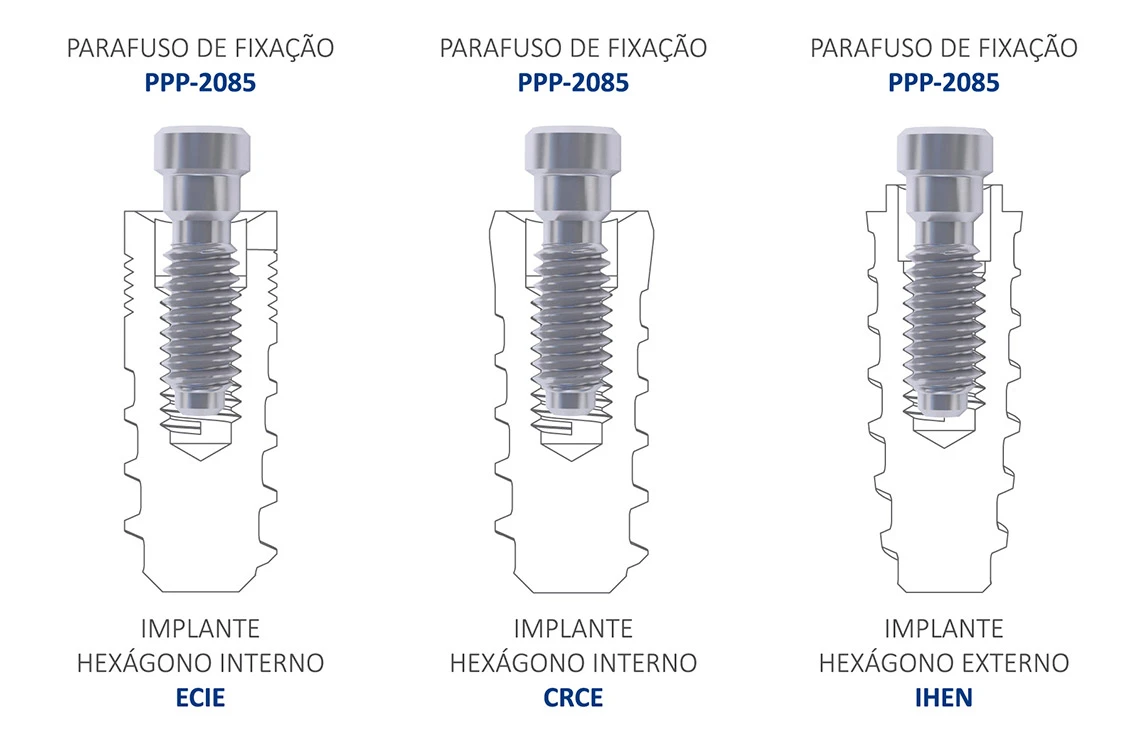 Implante Hexágono Externo ou Hexágono Interno Medens use o mesmo parafuso!