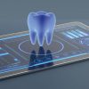Fluxo Digital na Implantodontia