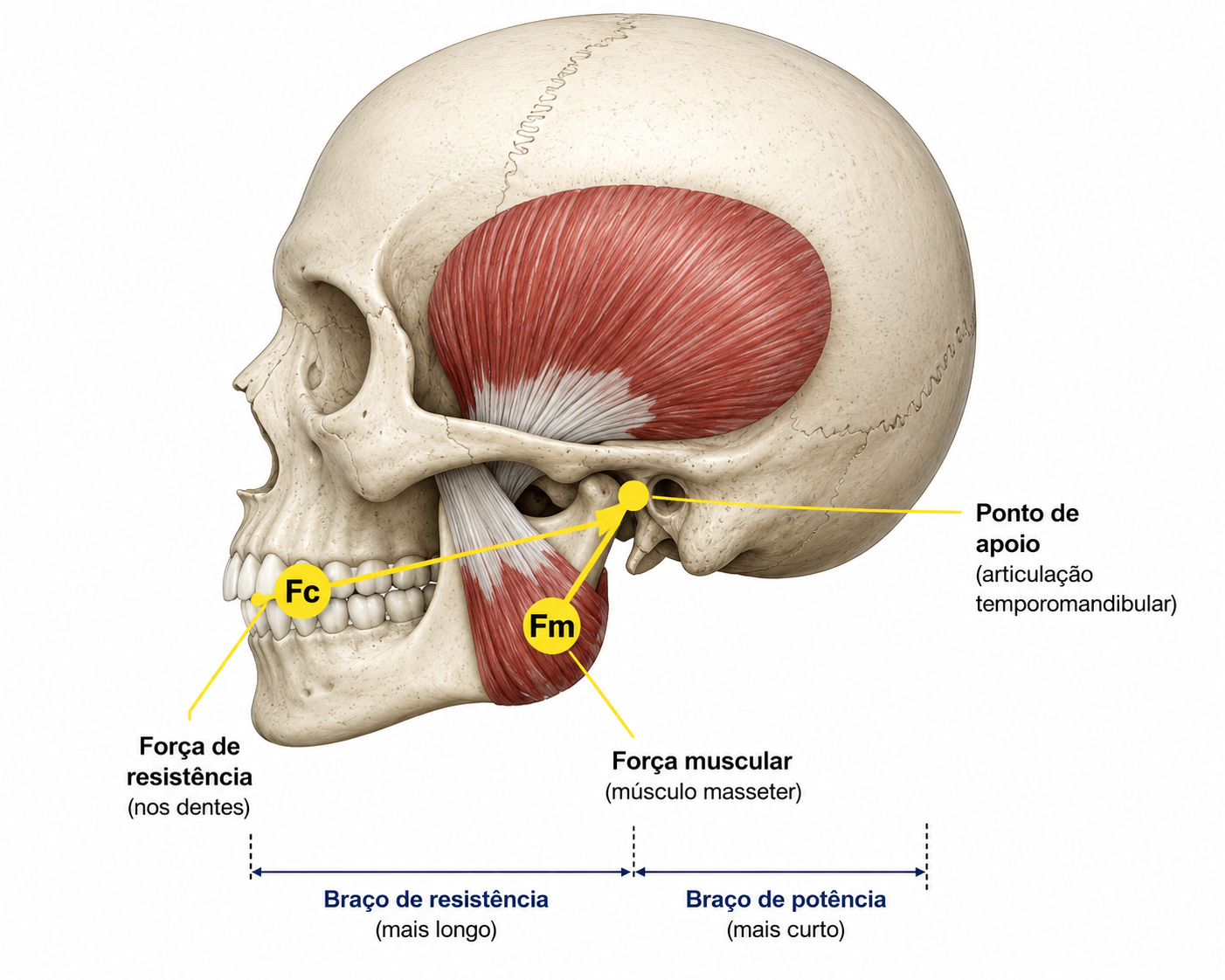 força